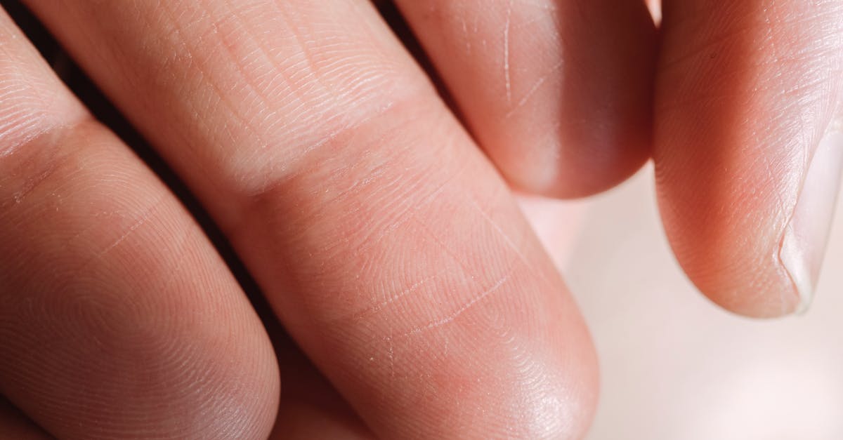 Can You Blowtorch A Pig Skin to Make it Crispy? - Human Palm in Close Up Photography