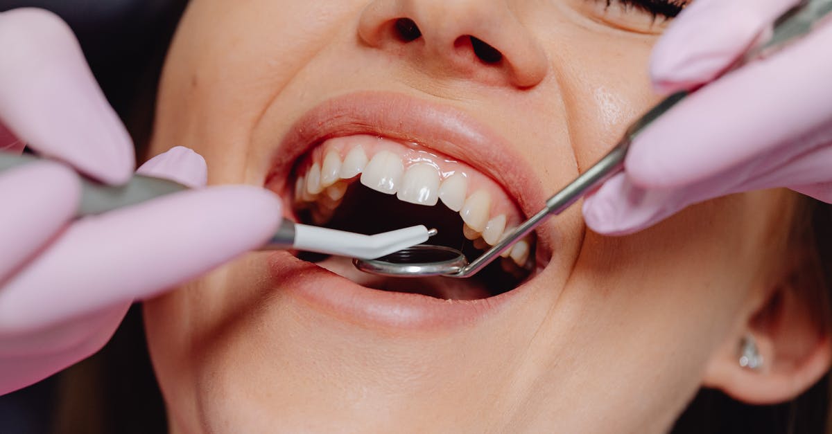 Do gums have any nutritional value? -  Opened Mouth Woman During Dental Treatment
