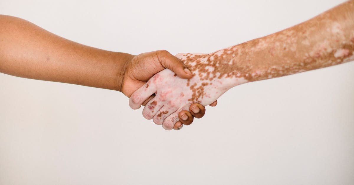 Multilayered brownie help - Crop anonymous man shaking hand of male friend with vitiligo skin against white background